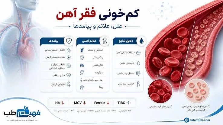 کم خونی ناشی از فقر آهن